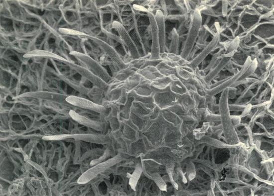 Figure 2. Young cleistothecium of
Microsphaera azaleae on R. mekongense.